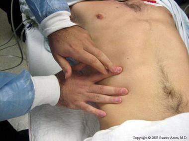 Percussion over the liver. 