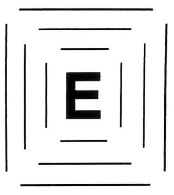 Eccentric "E" used to retrain fixation away from a