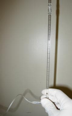Cerebrospinal fluid (CSF) manometer attached to tu