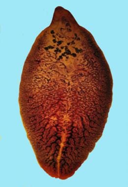 platyhelminthes trematoda fasciola hepatica