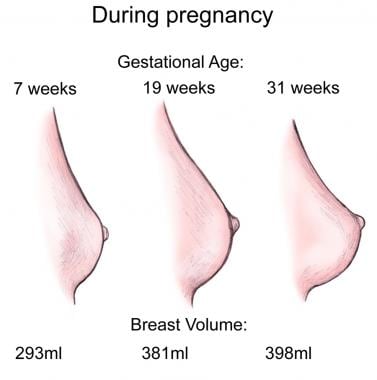 Breast changes during pregnancy. 