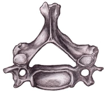 Cervical vertebra. 