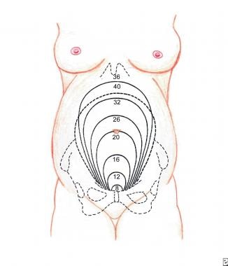 Uterine fundal size and relative position on abdom
