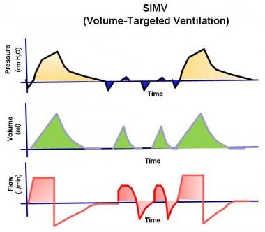 Mechanical Ventilation Background Classifications Of