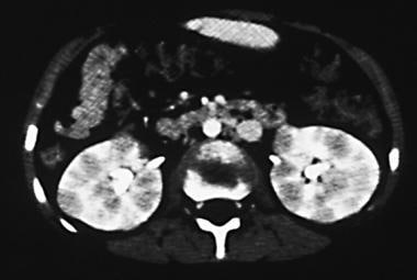 Contrast-enhanced computed tomography scan in a 15