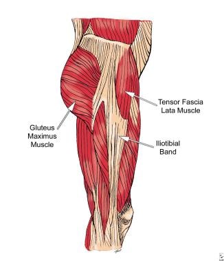 Treating the Iliotibial Band (ITB), Tensor Fasciae Latae (TFL), Hip  Restrictions, Hip, ITB, ITBS and more