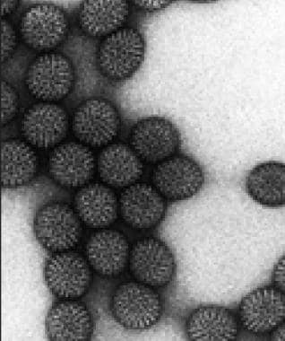 Transmission electron micrograph of rotavirus. Ima