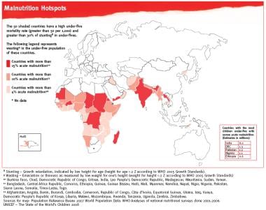 Malnutrition hotspot map. Image courtesy of the Wo