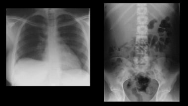 Chest and abdominal radiographs on a previously he