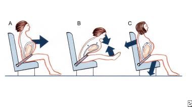 Round Ligament Pain During Pregnancy: Causes and Treatment - Babe by Hatch