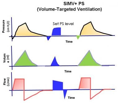 The pressure, volume, and flow to time waveforms f