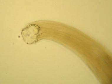 Adult Necator americanus worm. Anterior end with m