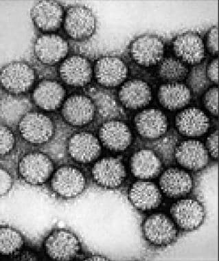 Transmission electron micrograph of intact rotavir