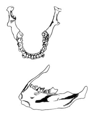 Anatomy of the mandible. 