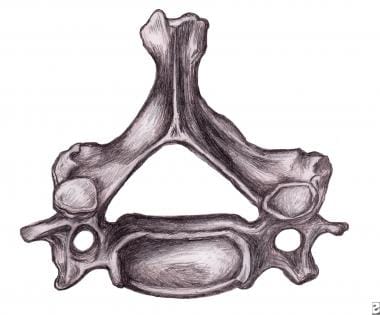 Cervical vertebra. 