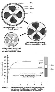 Physiopathological principle of arm circumference 