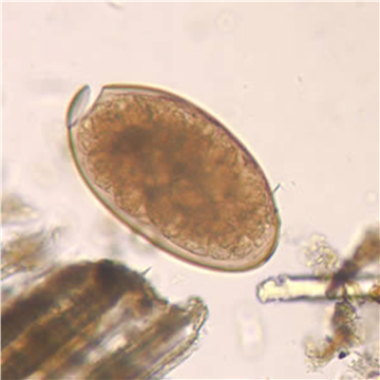 fasciola hepatica slide