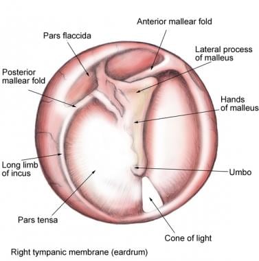 Tympanic membrane (TM): pars flaccida (superior to