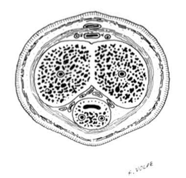 Transverse section of the penis at midshaft level.