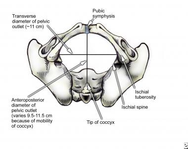 The inferior view of a pelvis. 