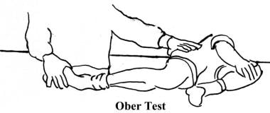 The Ober test. 