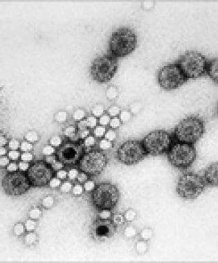 Rotavirus Workup: Laboratory Studies