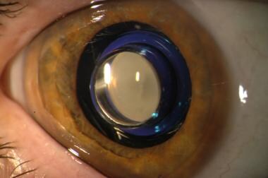 How Do I Withdraw Oet Helpdesk How Do I Withdraw Oet Helpdesk