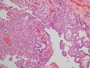This histologic section stained with hematoxylin a