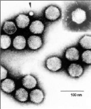A virus image from the International Committee on 