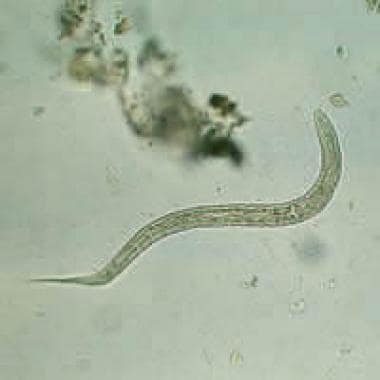 Hookworm rhabditiform larva (wet preparation). Cou