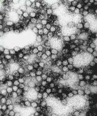 Yellow fever virus. Image courtesy of the Centers 