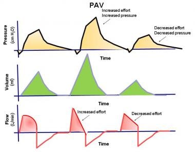 The pressure, volume, and flow to time waveforms f