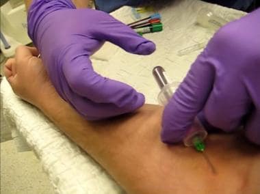 Phlebotomy. Holding device in place and filling tu