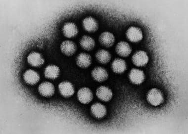 Transmission electron micrograph of adenovirus. Im
