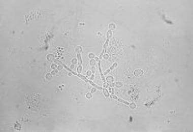 Candida albicans photomicrograph. Courtesy of Cent