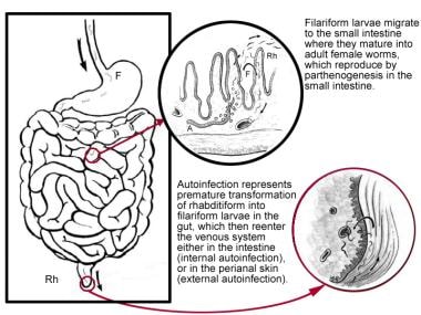 Third stage, life cycle of Strongyloides stercoral
