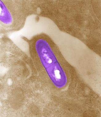 Electron micrograph of an artificially-colored Lis