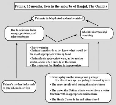 Marasmus Clinical Presentation History Physical Causes