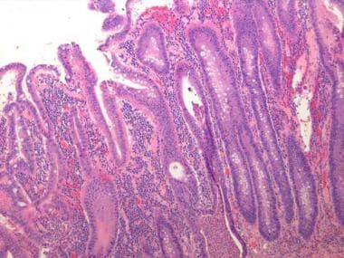 jejunum vs ileum histology