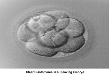 Infertility. Clear blastomeres in a cleaving embry