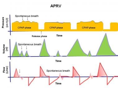 The pressure, volume, and flow to time waveforms f