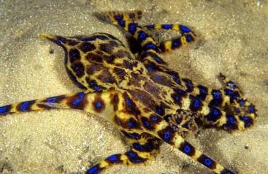 Tien bezoeker Hoogland Octopus Envenomation: Background, Pathophysiology, Etiology