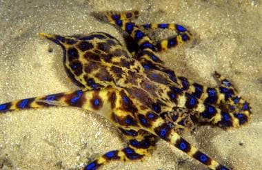 blue ringed octopus sting