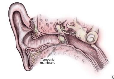 Tympanic membrane (TM) as continuation of the uppe