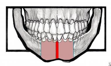 The broad red line indicates the symphyseal area. 