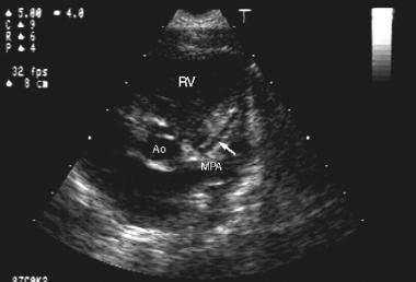 Two-dimensional echocardiographic image (parastern