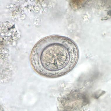 
H nana egg in an unstained wet mount. Courtesy of