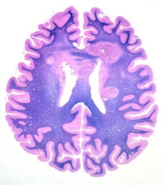 A whole-mount histologic section of a brain staine