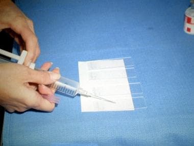 Photograph showing an aspirate being placed on a g