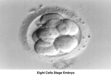 Infertility. Embryo (8-cell stage). Image courtesy